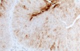 Anti-Uroplakin III CE/IVD for IHC - Genitourinary pathology