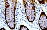 Anti-Villin CE/IVD for IHC - Gastrointestinal pathology