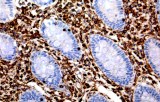 Anti-Vimentin CE/IVD for IHC - Soft Tissue pathology