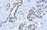 Anti-WT1 CE/IVD for IHC - Gynecological pathology