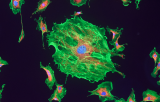 ETV6 probe for ISH CE/IVD - Sarcomas