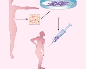 Usos médicos y terapéuticos de las células madre