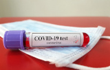 Serological tests