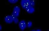 Citogenética molecular