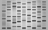 Consumibles para Western Blot