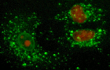 Microscopía fluorescente