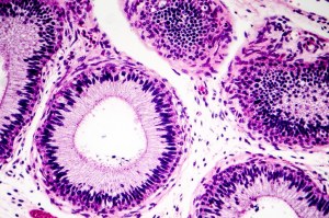 Optimice sus resultados de IHC