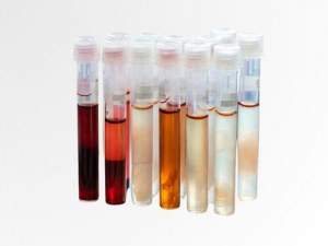 De donante a datos: su recurso de muestras humanas