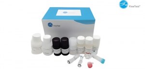 Ahorre un 30 % en reactivos seleccionados de Finetest