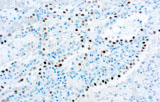 Anti-TTF-1 CE/IVD para IHC - Patología pulmonar