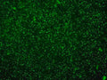 Immunohistochemistry detection of ChAT in Coronal section of rat neocortex tissue using Anti-Choline Acetyltransferase (ChAT) Antibody (Cat. 315-CHAT). Tissue was mounted and pariffin fixed. Heat induced antigen retrieval was performed using citrate buffer, heated, and then blocked. After washing, the primary antibody (Cat. 315-CHAT) was incubated with the sample. 315-CHAT showing the choline acetyltransferase positive cholinergic nerve fibers and terminals. Reference: D. Anandh, K Shobha and Dr. Bindu M Kutty, Department of Neurophysiology, National Institute of Mental Health and Neurosciences, Bangalore, India.