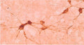 Immunohistochemistry detection of ChAT in rat organotypic slice cultures of septum tissue using Anti-Choline Acetyltransferase (ChAT) Antibody (Cat. 315-CHAT). Tissue was mounted and pariffin fixed. Heat induced antigen retrieval was performed using citrate buffer, heated, and then blocked. After washing, the primary antibody (Cat. 315-CHAT) was incubated with the sample at 1:100.