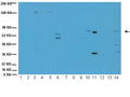Western blot detection of ChAT using Anti-Choline Acetyltransferase (ChAT) Antibody (Cat. 315-CHAT). Gel was loaded with A431 (Lane1), C2C12 lysate (Lane2), HEK293 lysate (Lane 3), Hela lysate (Lane 4), HepG2 lysate (Lane 5), Human Placenta lysate (Lane 6), Huvec lysate (Lane 7), Jurkat lysate (Lane 8), L6 lysate (Lane 9), Mouse brain lysate (Lane 10), NIH/3T3 lysate (Lane 11), PC12 lysate (Lane 12), PC3 lysate (Lane 13), RAW264.7 lysate(Lane 14. Proteins were transferred to the PVDF membrane, blocked, and then washed with a buffer. Primary antibody was incubated with sample at 1:1000 and then detected via chemiluminescence using rabbit anti-goat secondary antibody conjugated to HRP. Arrow indicates protein ChAT (~68-70 kDa).