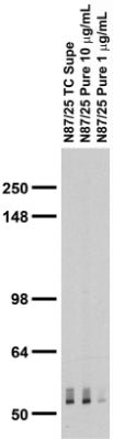 Adult rat brain membrane immunoblot.