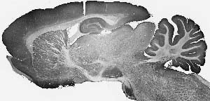 Whole adult rat brain immunohistochemistry.
