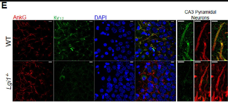 Left, 63× images of Kv1.2 immunoreactivity at CA3 Axonal Initial segments in WT (top panels) and Lgi1−/− (bottom panels). Scale bar = 10 μm. Right, detail of a CA3 pyramidal neuron AIS in WT (top panels) and Lgi1−/− (bottom panels).