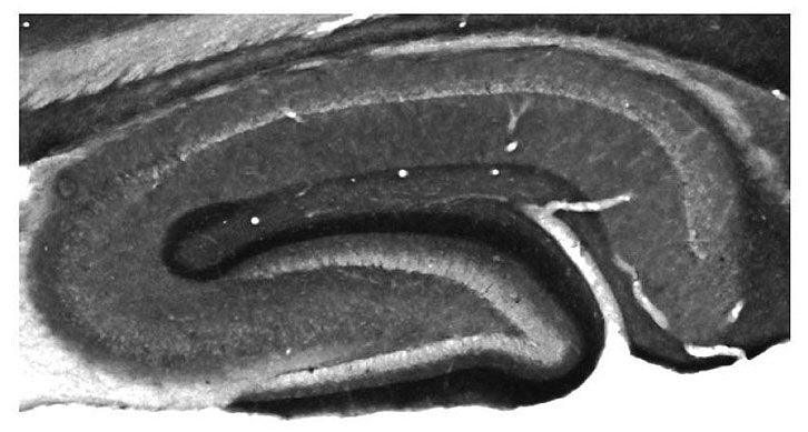 Adult rat hippocampus immunohistochemistry.