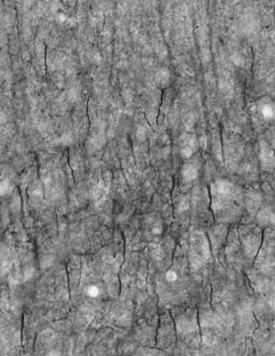 Adult rat cortex immunohistochemistry of axon initial segments.