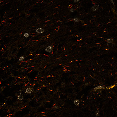 Immunostaining of mouse sliced optic nerve labeling Ankyrin G(Cat no 75-146, orange, 1:125) and Caspr (red). Nuclei are stained with DAPI. Image was taken at the CRL Molecular Imaging Center, RRID:SCR_017852, supported by the Helen Wills Neuroscience Institute. Image kindly provided by Anna Elleman, UC Berkley.