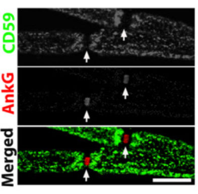 CD59 (green) and ankyrin-G (AnkG, cat. 75-146; red) staining of WT murine teased fibers. Image from publication CC-BY-4.0. PMID:37875972