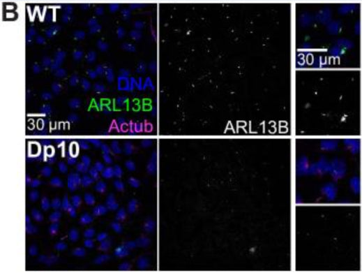 Representative confocal images of WT and Dp10 mouse embryonic fibroblasts. Cells were stained with Hoechst 33342 (blue), the ciliary marker ARL13B (cat. 75-287, 1:500; green), and Actub (magenta). Image from publication CC-BY-4.0. PMID:36656118