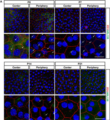 Confocal images from flat mount mouse retina samples at different postnatal ages showing the peripheral or central areas of RPE. ZO-1 staining cell junctions (red), Arl13b is a ciliary marker (cat. 75-287, 1:2000; green), nuclei (blue). Magnifications of each corresponding image are shown. Image from publication CC-BY-4.0. PMID:37211572