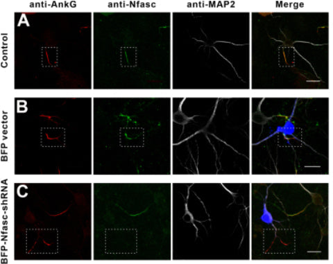 Immunostaining of mouse WT neurons (A) or neurons transfected with BFP vector (B), or BFP-Nfasc-shRNA (C) and stained for AnkG (red), Nfasc (green), and MAP2 (white). Image from publication CC-BY-4.0. PMID: 35850303