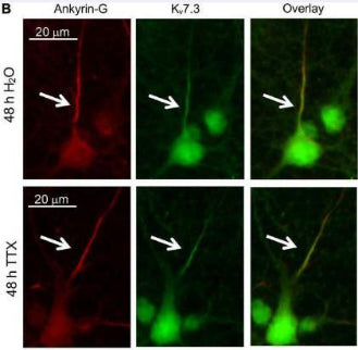 Cultured rat hippocampal neurons (DIV 11–12) were treated for 48 h with 1 μM TTX or its vehicle control (0.1% H2O) and subjected to immunocytochemistry with antibodies for the AIS marker ankyrin-G or Kv7.3. Image from publication CC-BY-4.0. PMID: 35966206