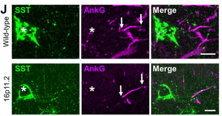 Representative micrographs showing immunohistochemical labelling for SSt (green), the AIS marker AnkyrinG (AnkG, magenta; cat. 75-146, 1:100), and their overlap (merge). The SSt soma is indicated with an asterisk (*) and the start and end of the AIS localised to that IN indicated (arrows). Image from publication CC-BY-4.0. PMID:36658491