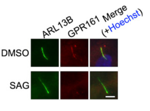 Immunostaining of KIF24-depleted Panc1 cells in serum-starved medium treated with DMSO or 1 μM SAG for 48 h. Cells were immunostained with anti-ARL13B (green) and anti-GPR161 (red) antibodies, DNA was stained with Hoechst (blue). Image from publication CC-BY-4.0. PMID: 35803737