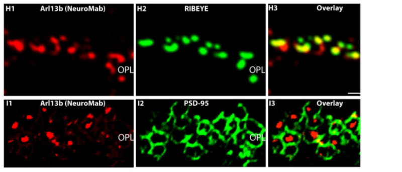 Semi-thin resin sections of the mouse retina were immunolabeled with affinity-purified mouse monoclonal antibody against Arl13b (NeuroMab) (H1,I1), rabbit polyclonal antibody against RIBEYE (U2656) (H2) and rabbit polyclonal antibody against PSD-95 (I2). Signals are overlaid in (H3,I3). Image from publication CC-BY-4.0. PMID: 35806143