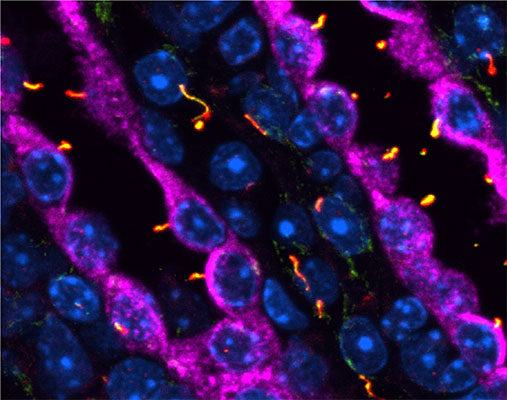 Spinning disc confocal image identifying localization of the atypical GTPase protein ARL13B (Cat 75-287, red) in primary cilium, marked by acetylated tubulin (green), in Aquaporin 2 (magenta) positive renal collecting ducts in a 24-day old mouse. Image kindly provided by Kevin White, UTSW-Dallas.
