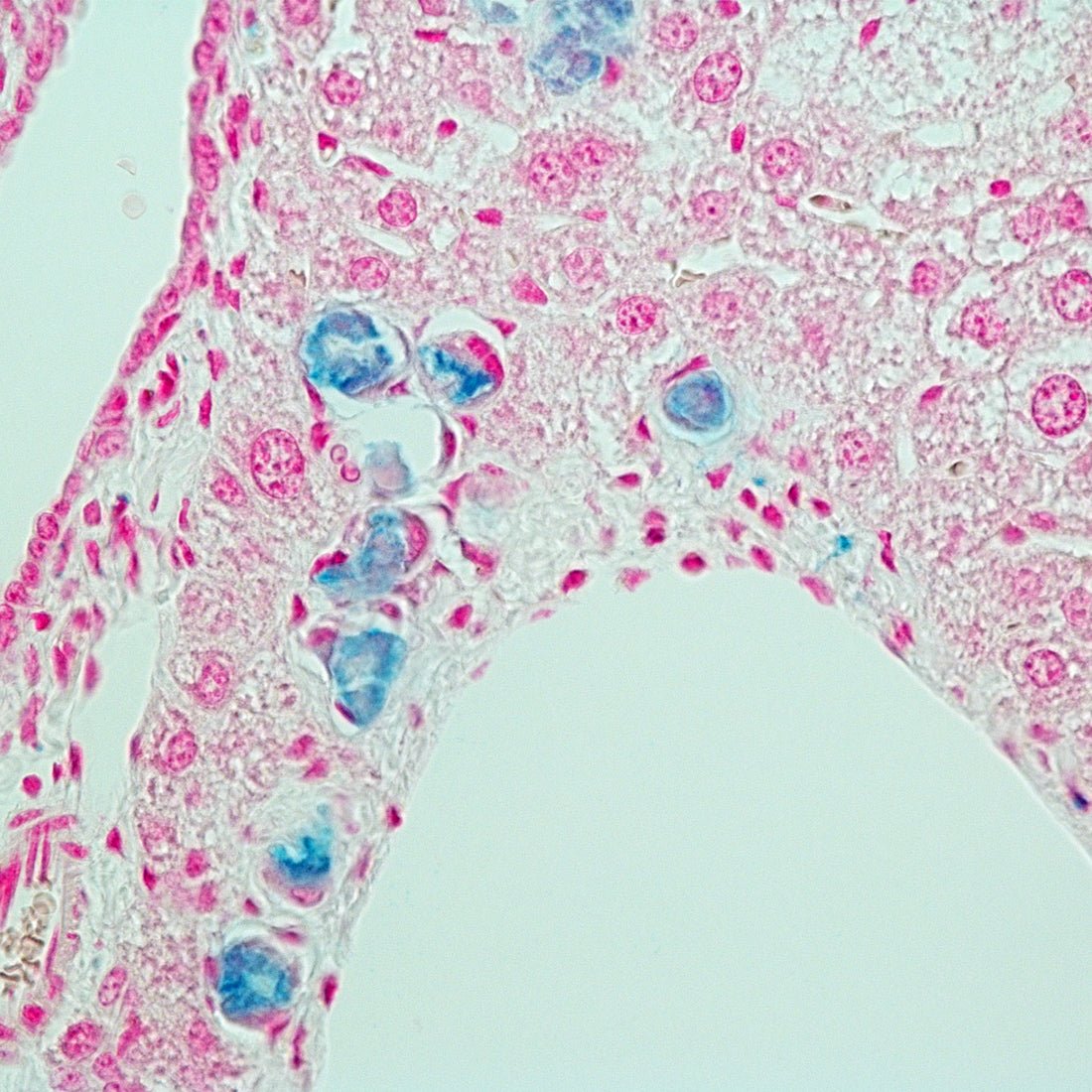 Prussian Blue Iron Stain Kit (Reaction for Demonstration of Iron) - Polysciences