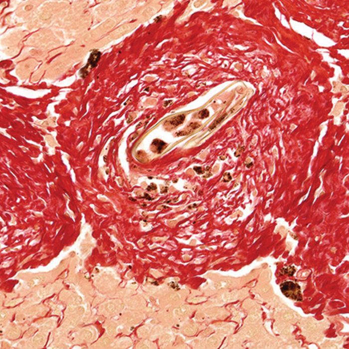 Picrosirius Red Stain Kit - Polysciences