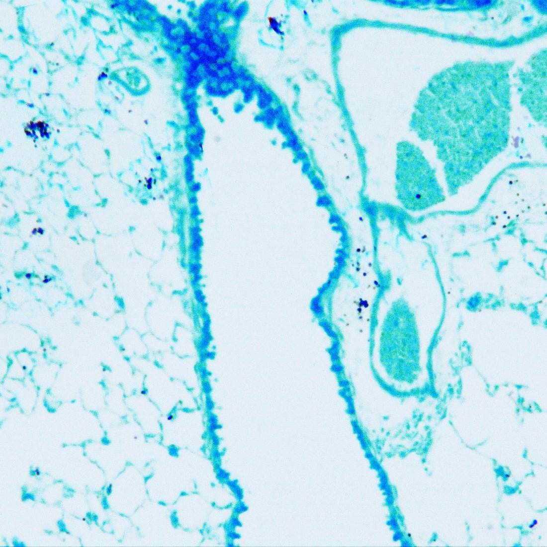 Grocott Methenamine Silver Stain (GMS) for Fungus & PCP - Room Temperature & Microwave Kit - Polysciences