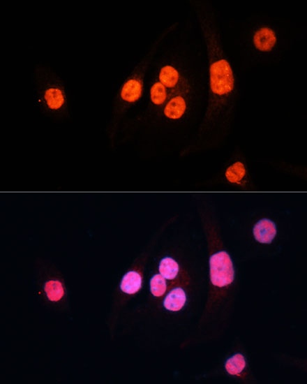 METTL3 Polyclonal Antibody - 2