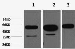 beta Tubulin Monoclonal Antibody - small - 1