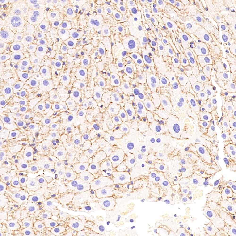 N-cadherin Polyclonal Antibody - 3