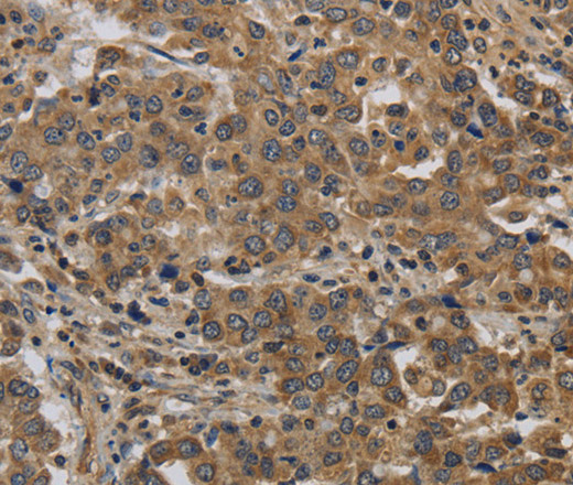 KIF4A Polyclonal Antibody - small - 1