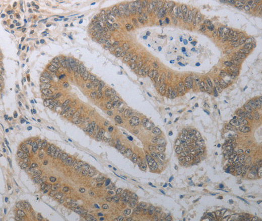 SHH Polyclonal Antibody - small - 2