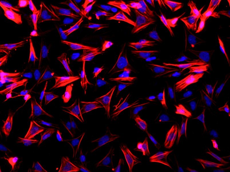 Rat Small Intestine Smooth Muscle Cell Complete Medium - 2