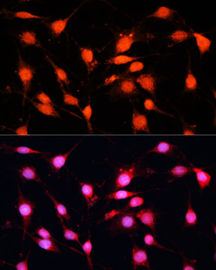 METTL3 Polyclonal Antibody - 1
