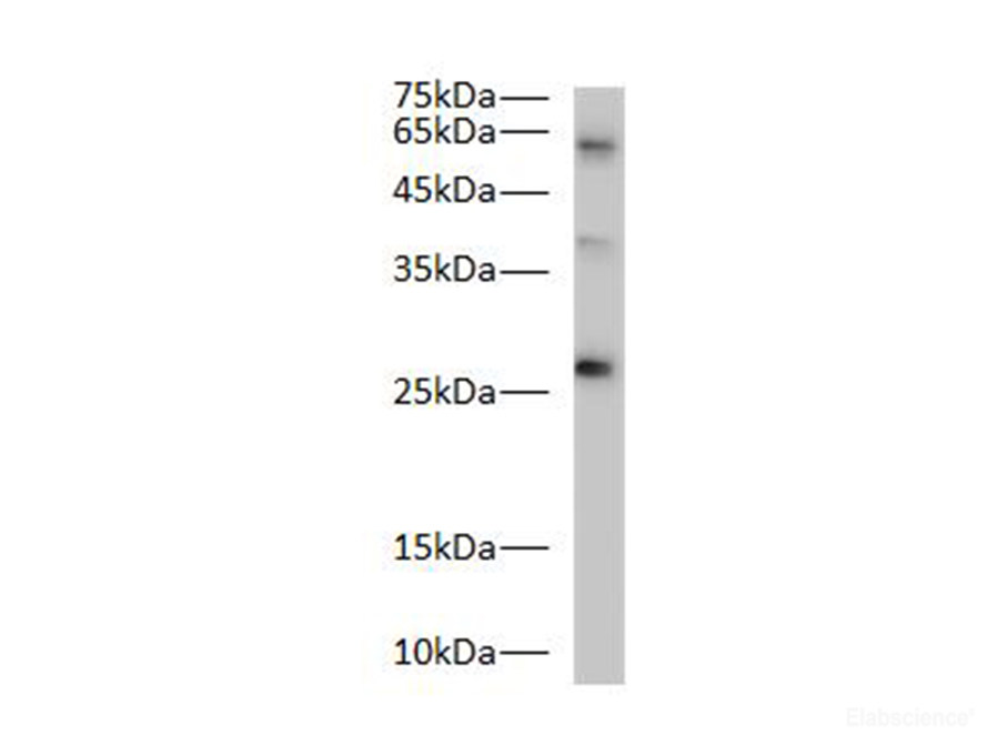 Bcl-2 Polyclonal Antibody - 1