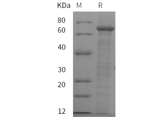 Recombinant Rat C4 Protein (His Tag) - 1
