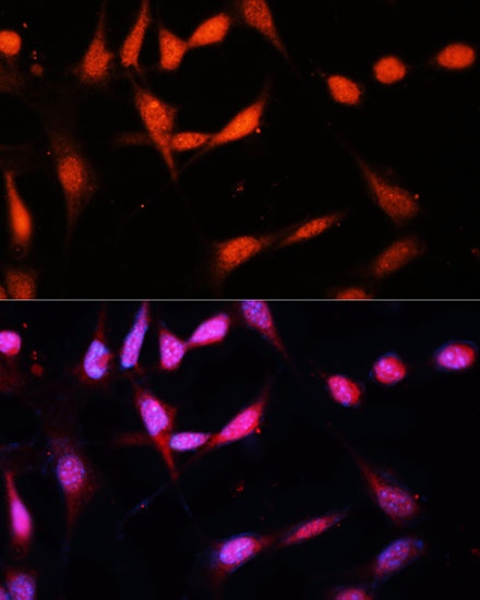 METTL3 Polyclonal Antibody - 3