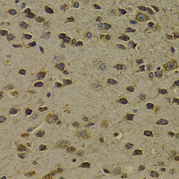 OGG1 Polyclonal Antibody - 1