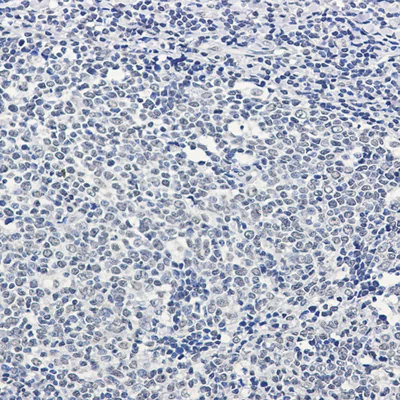 Recombinant PTBP1 Monoclonal Antibody - 2