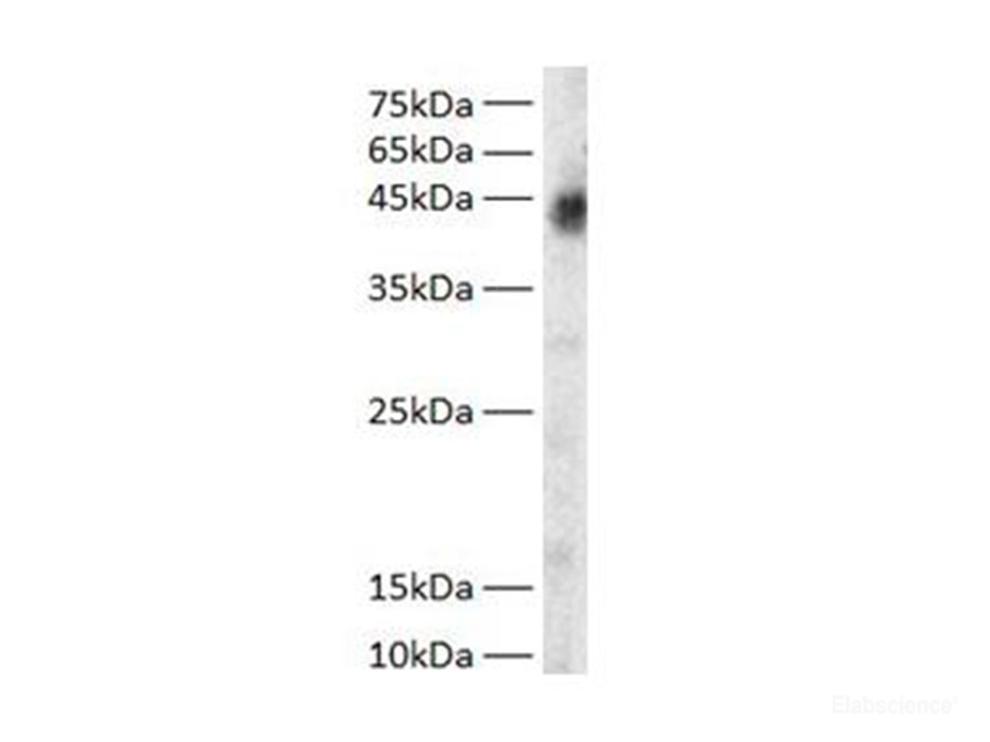 GOT1 Polyclonal Antibody - 1