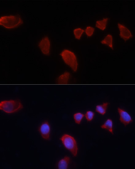 CA9 Polyclonal Antibody - small - 4