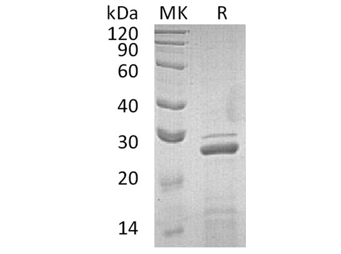 Recombinant Human Apolipoprotein A-I/ApoAI Protein - 1